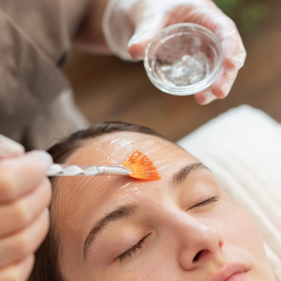 Peeling químico